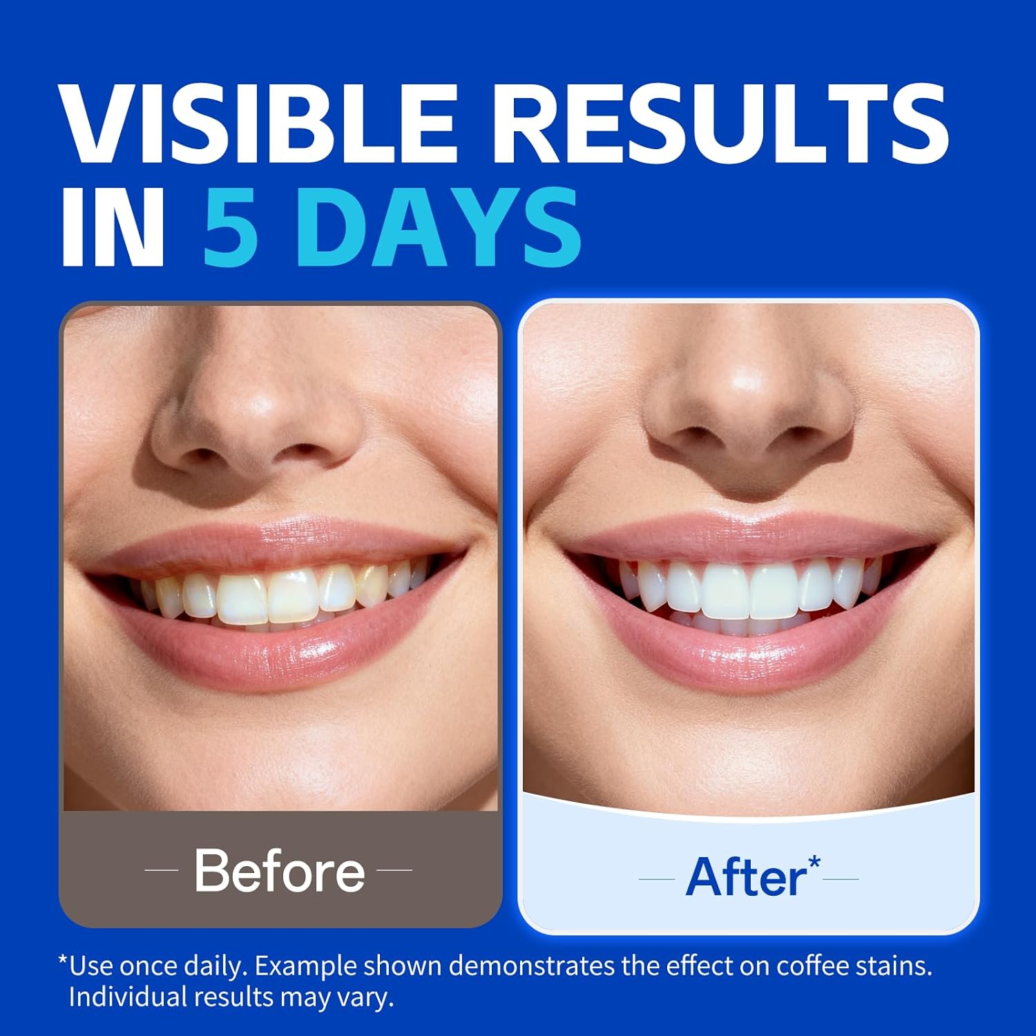 7 пар полосок для отбеливания  – обзор и цена Teeth Whitening Strips